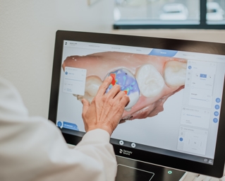 Making a restoration on CEREC Photo