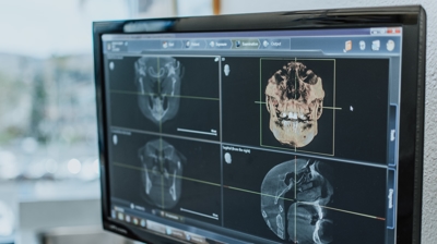Cone beam computed tomography (CBCT) image Photo
