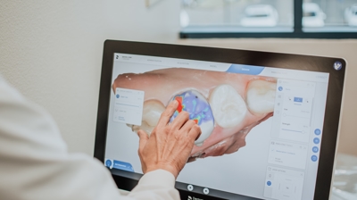 Making a restoration on CEREC Photo